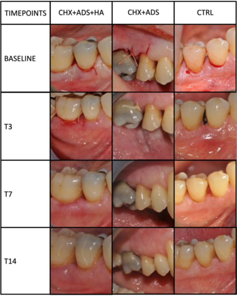 Klinične fotografije napredovanja celjenja ran v treh študijskih skupinah