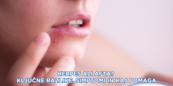 Herpes ali afta? Ključne razlike, simptomi in kaj pomaga