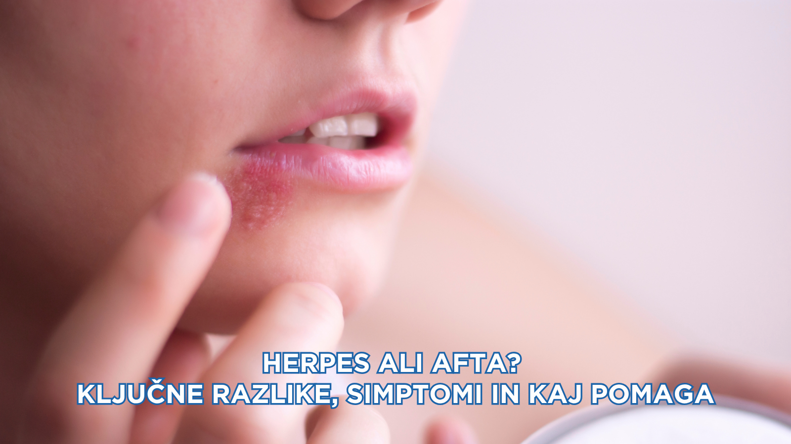 Herpes ali afta? Ključne razlike, simptomi in kaj pomaga